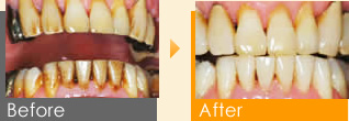 Before After