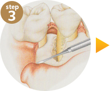 step3