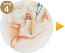 step4