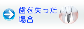 歯を失った場合